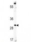 BDNF Antibody (CT)